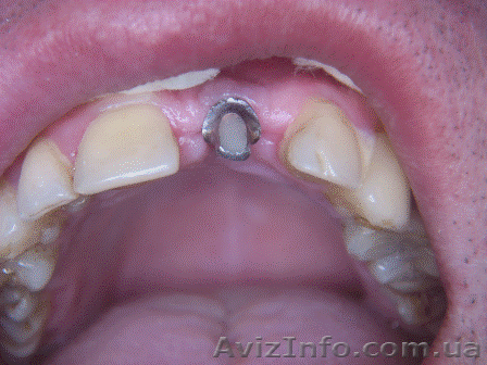 Стоматология в Полтаве - <ro>Изображение</ro><ru>Изображение</ru> #1, <ru>Объявление</ru> #5104