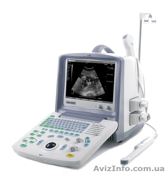 Ультразвуковой сканер для ветеринарии EMP 2000 Vet - <ro>Изображение</ro><ru>Изображение</ru> #1, <ru>Объявление</ru> #1085930