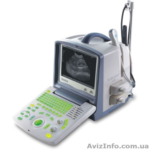 Ветеринарный УЗИ аппарат EMP 2100 Vet - <ro>Изображение</ro><ru>Изображение</ru> #1, <ru>Объявление</ru> #1085932